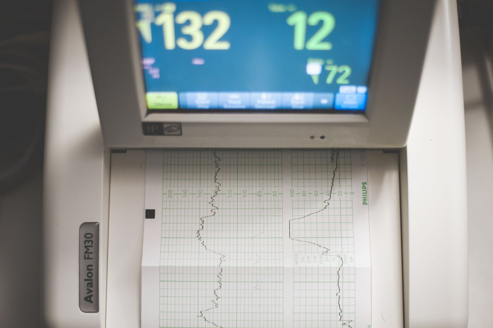 Breathing techniques and hydration fixes for early London heart rate spikes